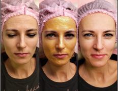 Студия красоты Valeria Studio (Валерия Студия), Уход за лицом - фото 10