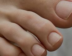 Студия ногтевого сервиса VVStudio (ВВСтудио), Подология - фото 4