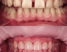 Стоматология Триомед, Примеры работ (ортопедия) - фото 2