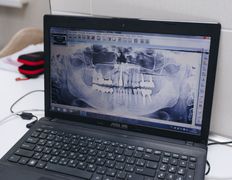 Стоматология УлыбкаСервис, Галерея  - фото 12