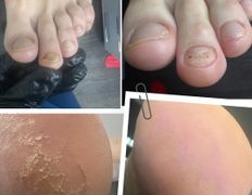 Центр подологии и эстетики Чистая стопа, Подология - фото 4