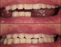 Стоматология Триомед, Примеры работ - фото 7