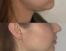 Эстетик центр Изуми, Примеры работ - фото 5