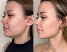 Эстетик центр Изуми, Примеры работ - фото 4