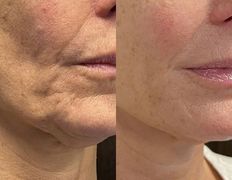 Эстетик центр Изуми, Примеры работ - фото 9