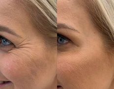 Эстетик центр Изуми, Примеры работ - фото 8