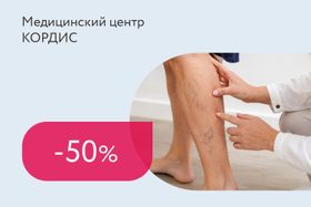 Скидки до 50% на лечение варикозной болезни