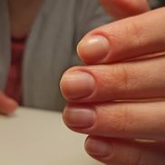 Neprostonogti - фото 2