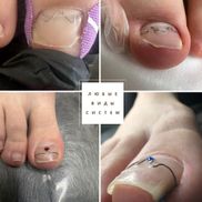 Чистая стопа - фото 2