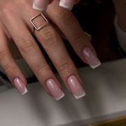 Мильфей - фото 2