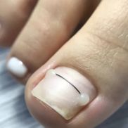 СТОПА - фото 5