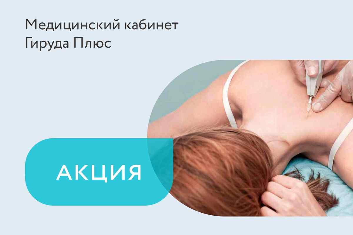 Акция «Бесплатная консультация рефлексотерапевта + 2 бесплатных сеанса карбокситерапии»
