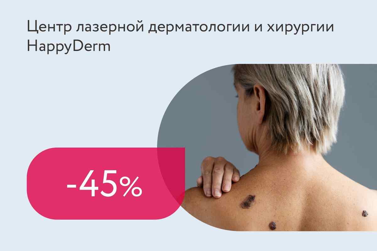 Скидки до 45% на удаление новообразований