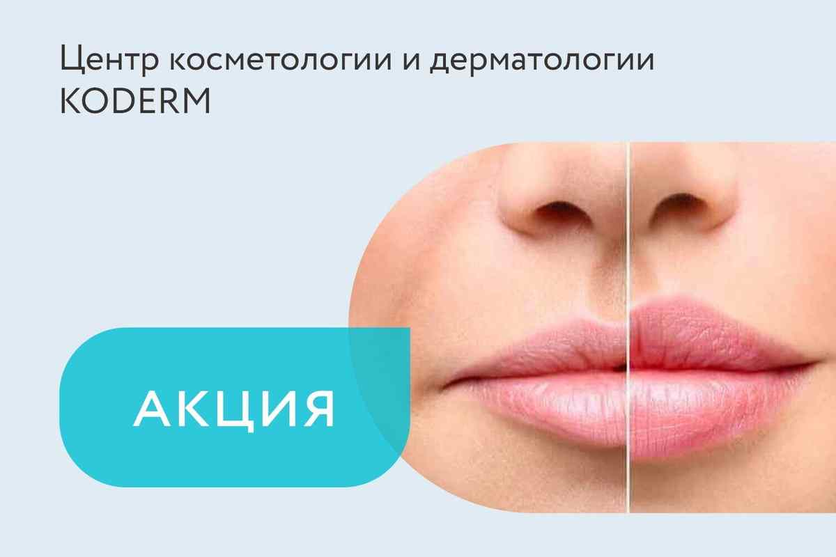 Скидка 30 BYN на увеличение губ