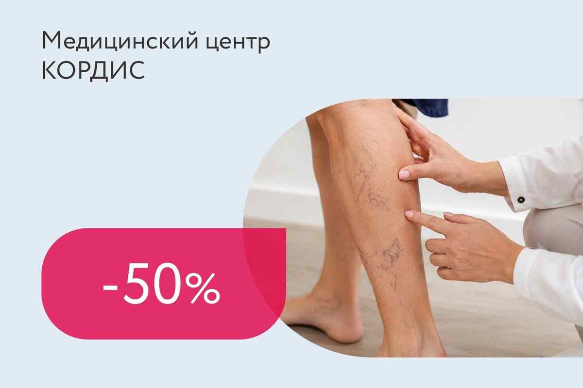 Скидки до 50% на лечение варикозной болезни