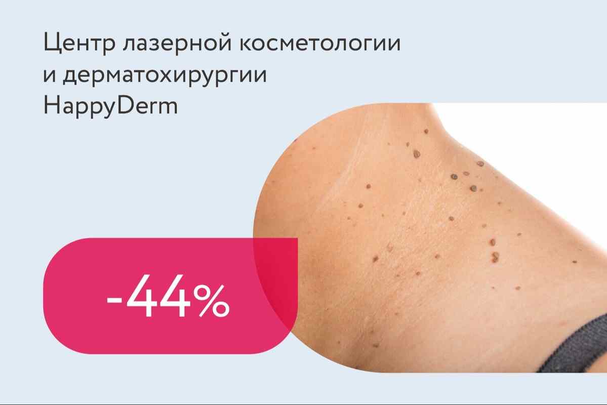 Скидки до 44% на удаление новообразований до 2 мм