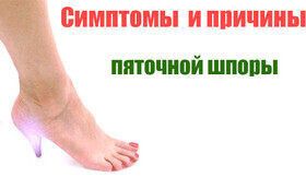 Пяточная шпора: иди по жизни легко!