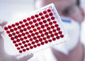 Биологическая медицинская страховка все более популярна в Беларуси