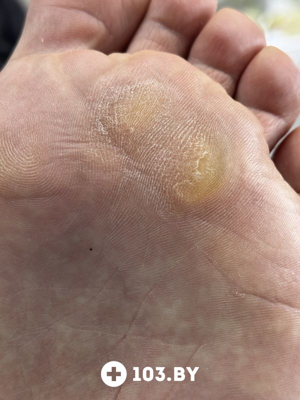 Подология Студия подологии и эстетики «IloNails studio (ИлоНеилс студио)» - фото 2801556