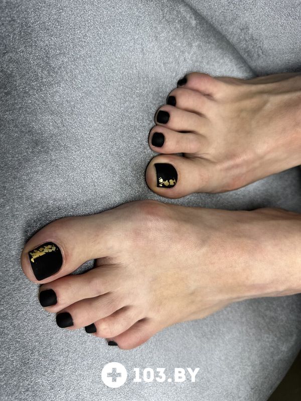 Педикюр Салон красоты «La Stella (Ла Стелла)» - фото 2788611