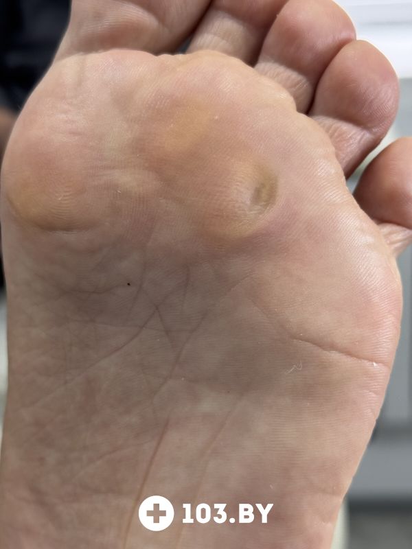 Подология Студия подологии и эстетики «IloNails studio (ИлоНеилс студио)» - фото 2801553