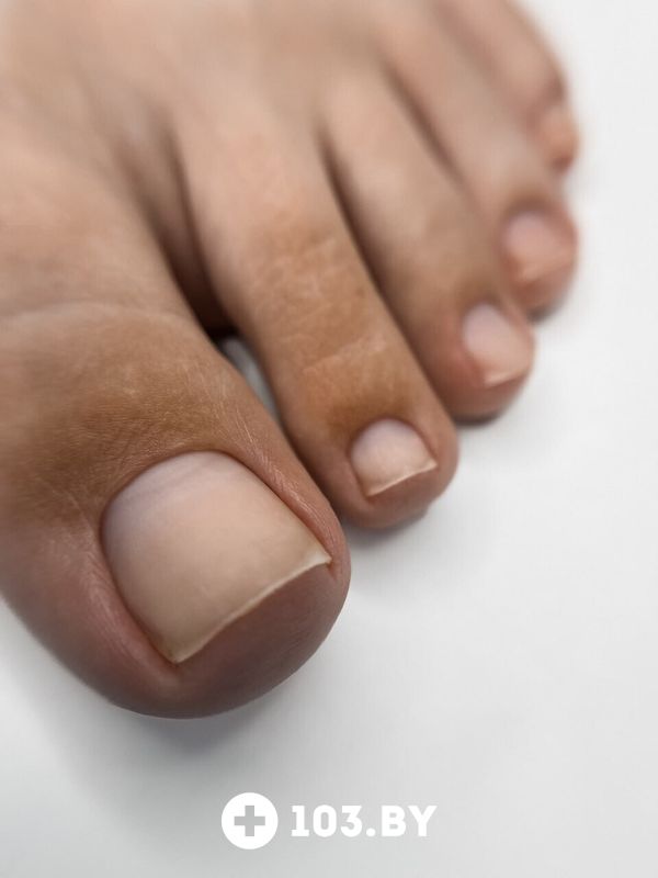 Примеры работ Центр подологии и маникюра «Студия 56» - фото 2772052