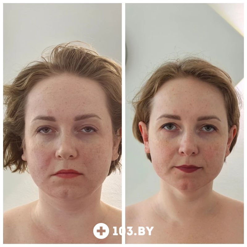 Галерея  «Косметический кабинет Натальи Торопович» - фото 2813041