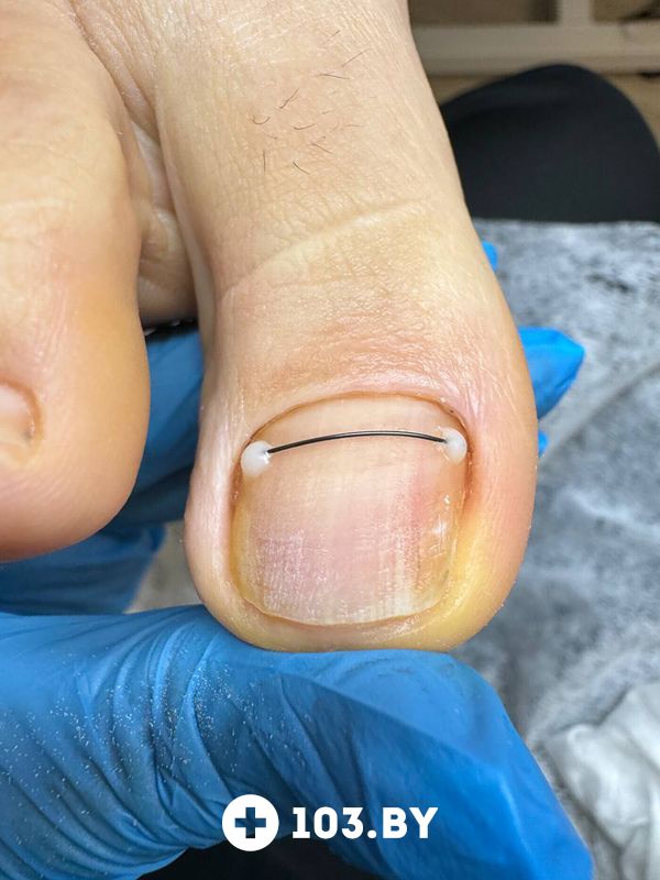 Примеры работ  «Центр подологии и эстетики Ольги Дударевич» - фото 2773738