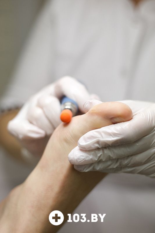 Прием подолога Центр здоровой стопы «AeroPod (АэроПод)» - фото 2773111