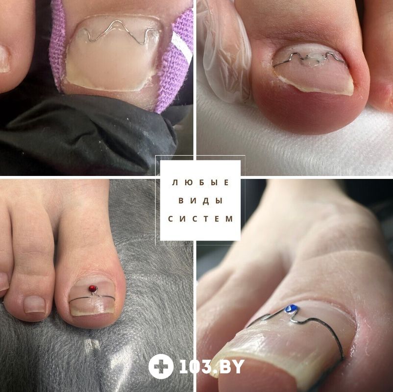 Подология Центр подологии и эстетики «Чистая стопа» - фото 2811355