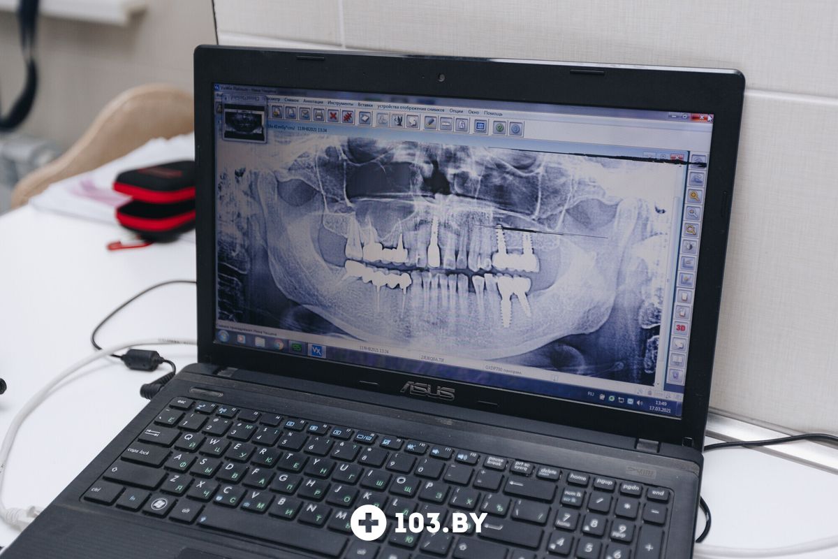 Галерея  Стоматология «УлыбкаСервис» - фото 2583173