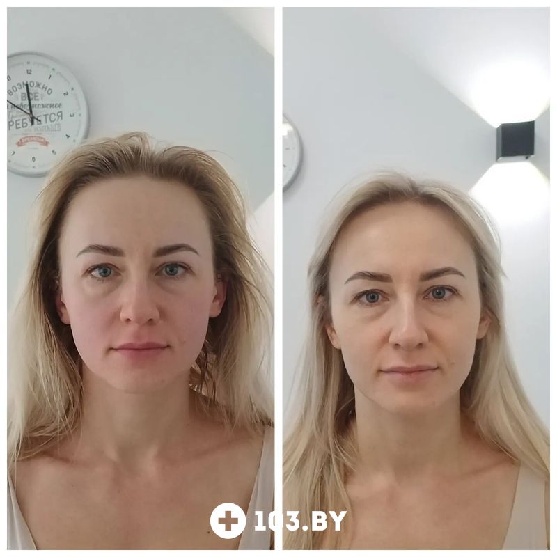 Галерея  «Косметический кабинет Натальи Торопович» - фото 2813032